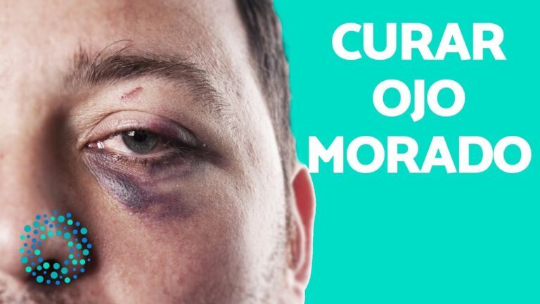 Trucos para eliminar moretones del ojo: ¡adiós a los hematomas!