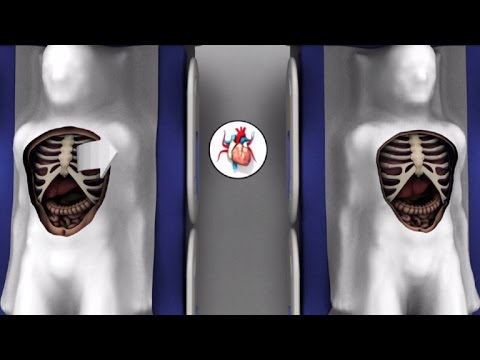 Aprende a donar órganos: paso a paso para una vida en servicio