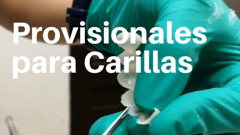 Descubre cómo crear carillas dentales caseras en solo 5 pasos