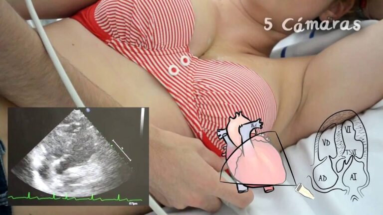 Descubre cómo se hace un eco doppler del corazón: la clave para una salud cardiaca
