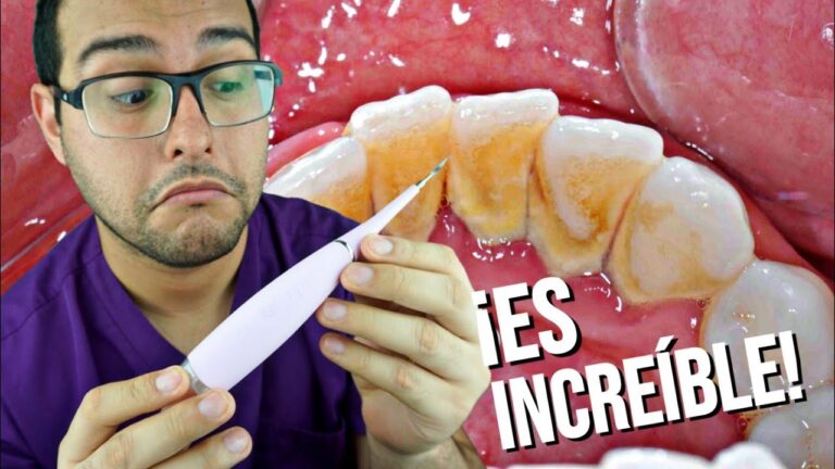 Descubre cómo hacer una limpieza bucal casera en 5 pasos