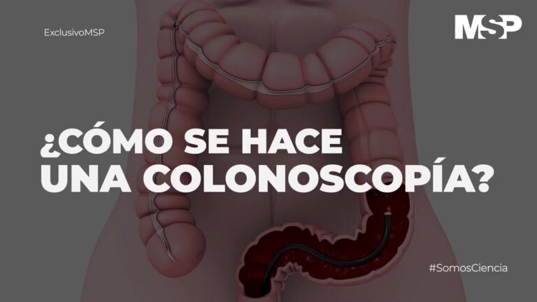 Descubre c&oacute;mo realizar una colonoscopia con sedaci&oacute;n para un proceso c&oacute;modo y sin dolor