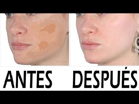 Desaparece manchas faciales: consejos infalibles en 7 pasos